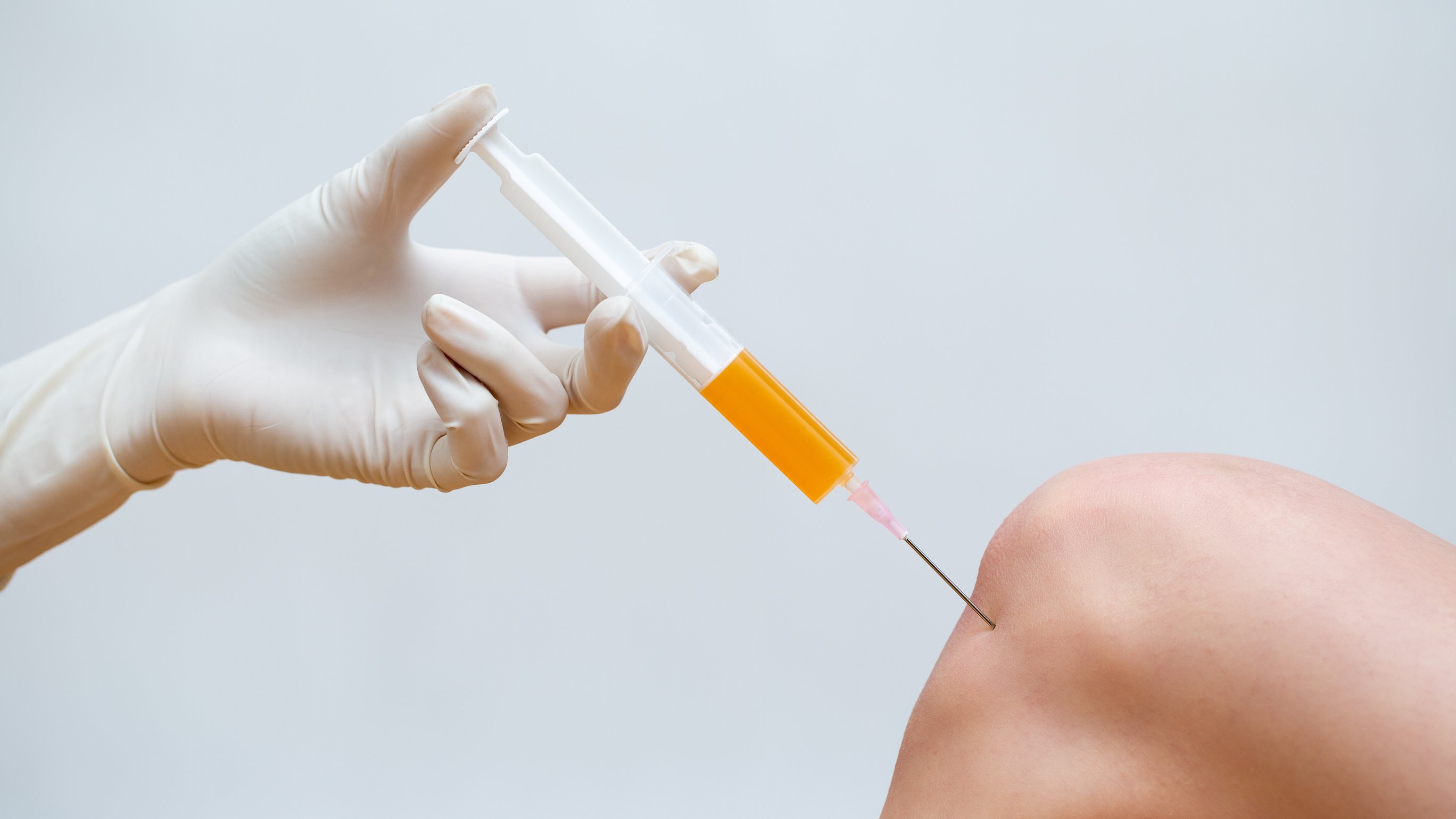 Doctor doing stem cell therapy on a knee with platelet-rich plasma injection.